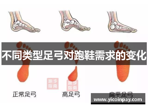 不同类型足弓对跑鞋需求的变化